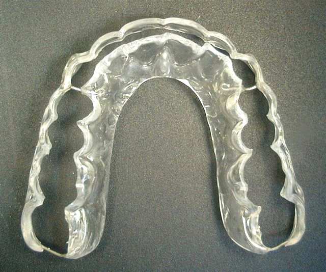 La gouttière